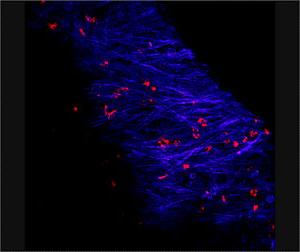 image of biofilm in a chinchilla ear