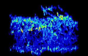 image of C. albicans biofilm